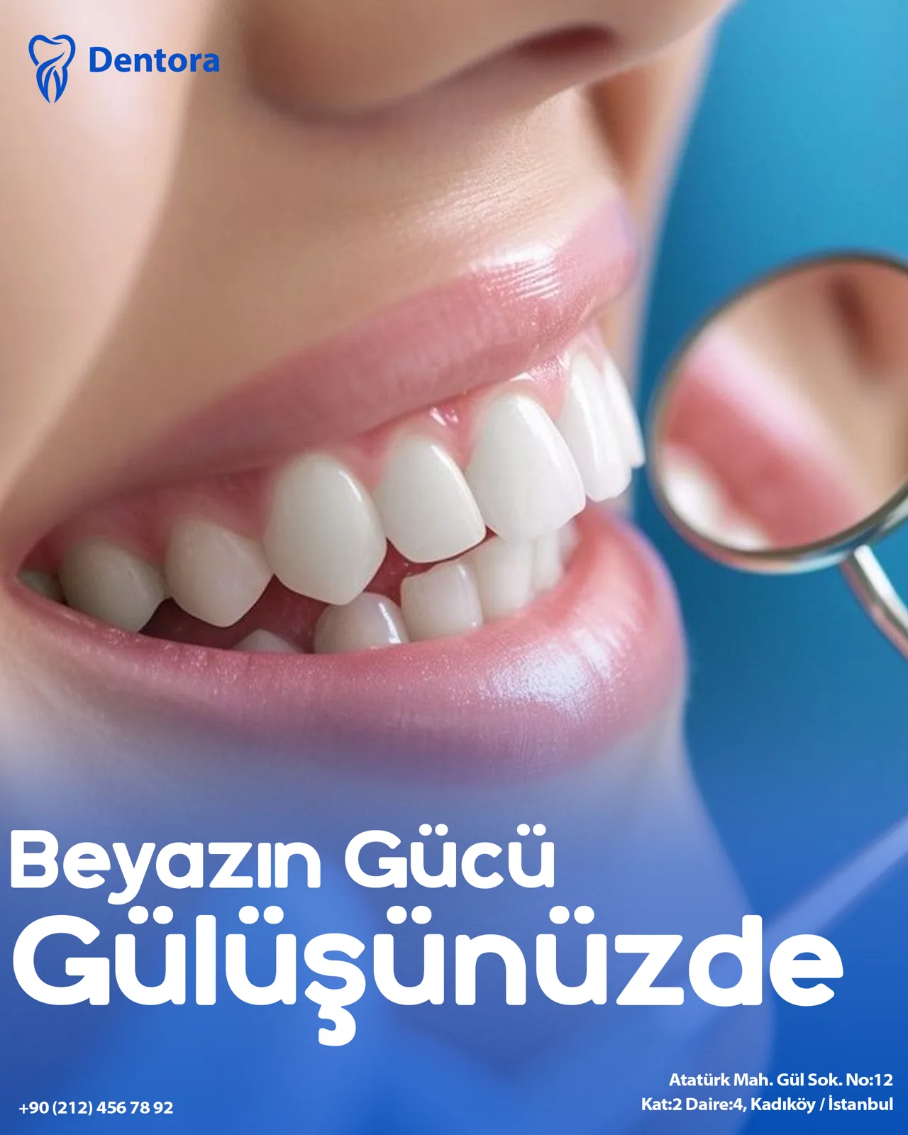 Dentora (Konsept) — Gönderi tasarımı 5